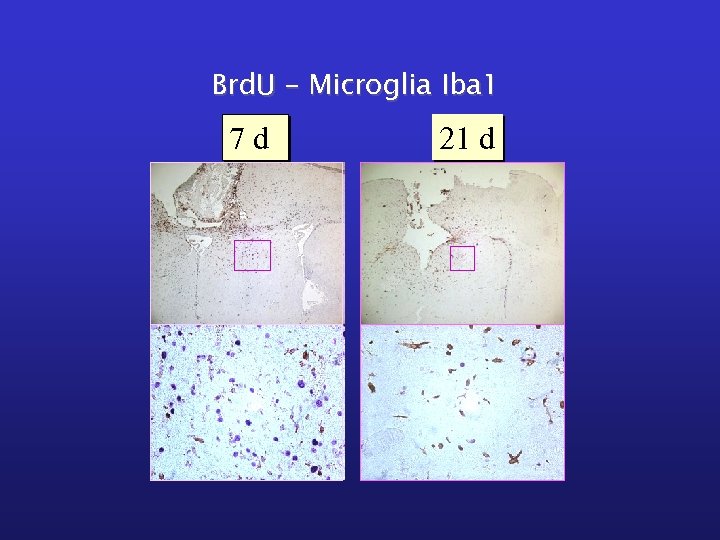 Brd. U – Microglia Iba 1 7 d 21 d 