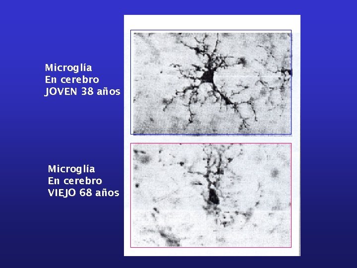 Microglía En cerebro JOVEN 38 años Microglía En cerebro VIEJO 68 años 