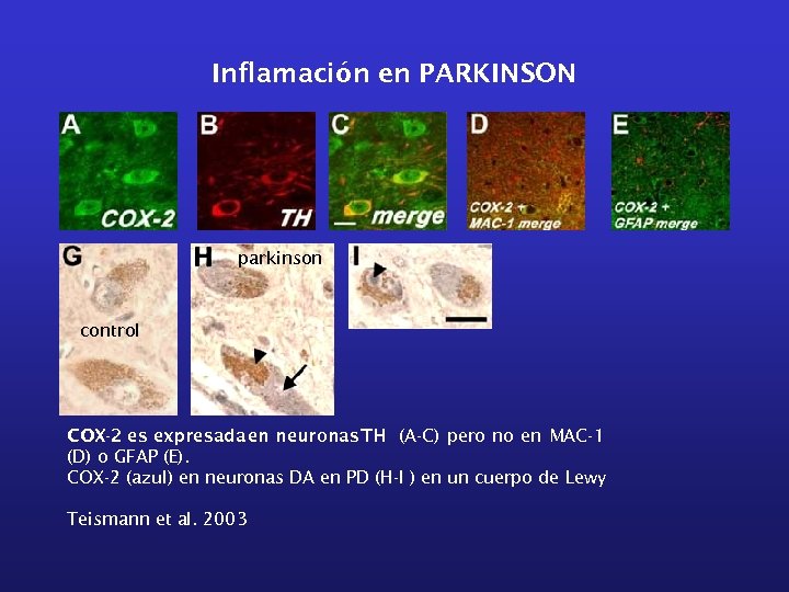Inflamación en PARKINSON parkinson control COX-2 es expresada en neuronas TH (A-C) pero no