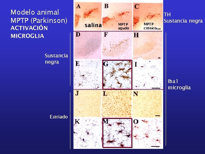Modelo animal MPTP (Parkinson) ACTIVACIÓN MICROGLIA salina MPTP agudo MPTP crónico TH Sustancia negra