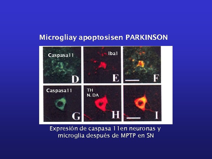 Microgliay apoptosisen PARKINSON Iba 1 Caspasa 11 TH N. DA Expresión de caspasa 11
