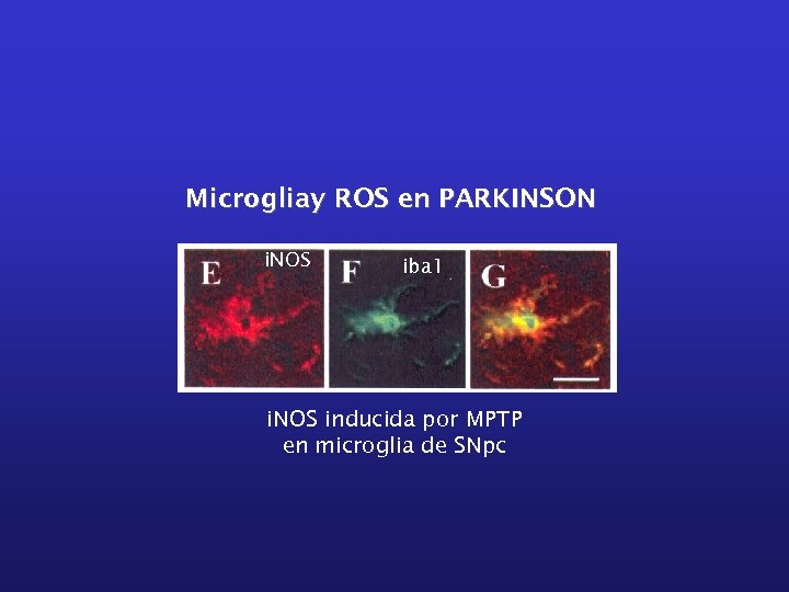 Microgliay ROS en PARKINSON i. NOS iba 1 i. NOS inducida por MPTP en