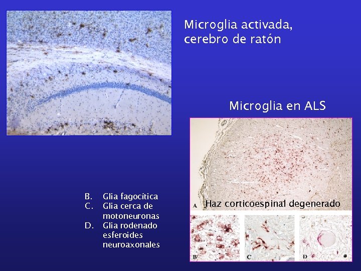 Microglia activada, cerebro de ratón Microglia en ALS B. C. D. Glia fagocítica Glia