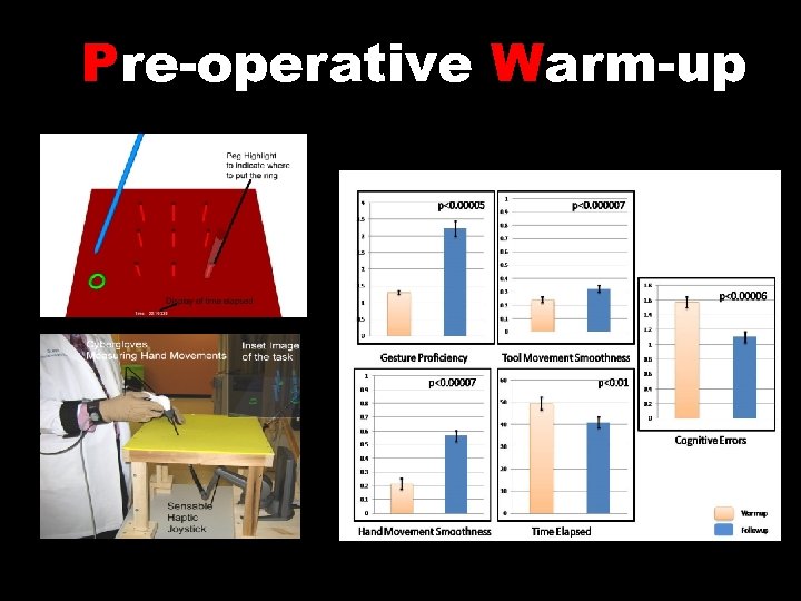 Pre-operative Warm-up 
