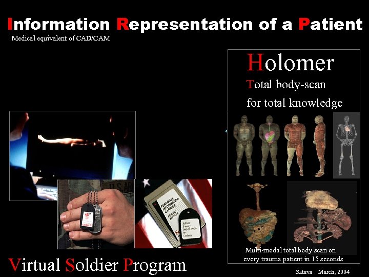 Information Representation of a Patient Medical equivalent of CAD/CAM Holomer Total body-scan for total