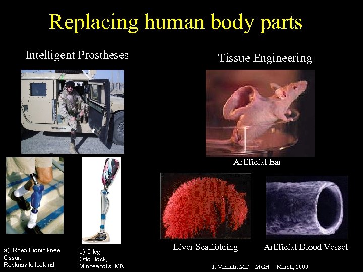 Replacing human body parts Intelligent Prostheses Tissue Engineering Artificial Ear a) Rheo Bionic knee