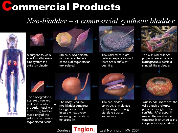 Commercial Products Neo-bladder – a commercial synthetic bladder A surgeon takes a small, full-thickness