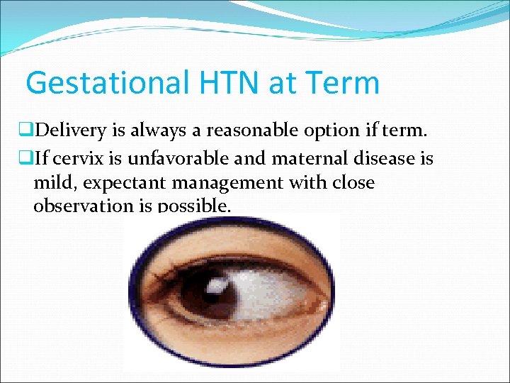 Gestational HTN at Term q. Delivery is always a reasonable option if term. q.