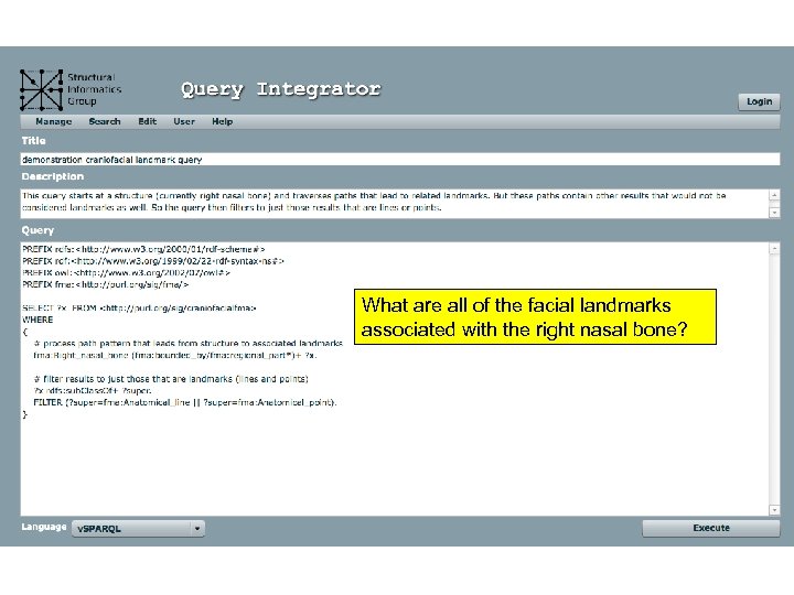 What are all of the facial landmarks associated with the right nasal bone? 