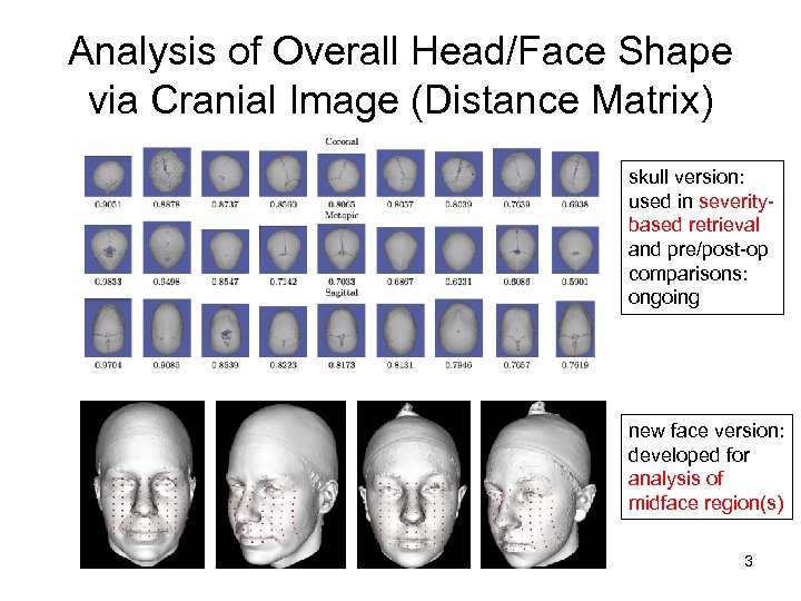 Analysis of Overall Head/Face Shape via Cranial Image (Distance Matrix) skull version: used in