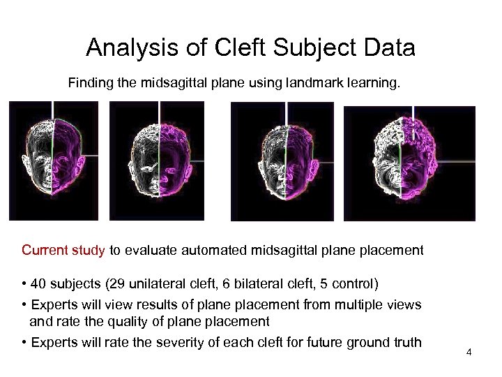 Analysis of Cleft Subject Data Finding the midsagittal plane using landmark learning. Current study