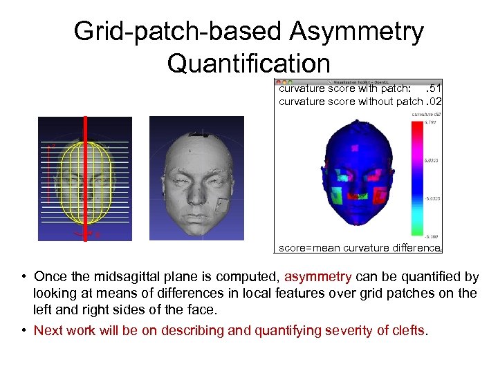 Grid-patch-based Asymmetry Quantification curvature score with patch: . 51 curvature score without patch. 02