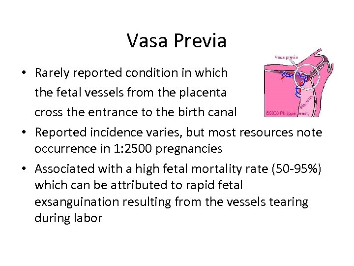 Vasa Previa • Rarely reported condition in which the fetal vessels from the placenta
