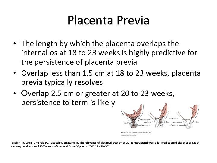 Placenta Previa • The length by which the placenta overlaps the internal os at
