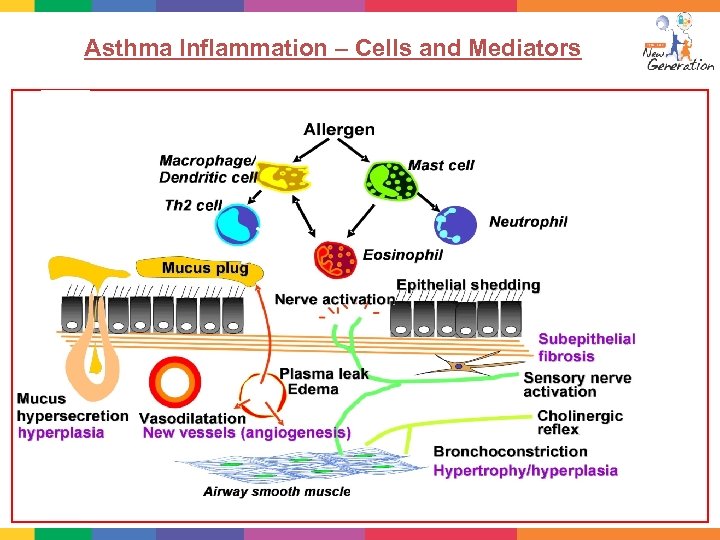 Asthma Inflammation – Cells and Mediators 