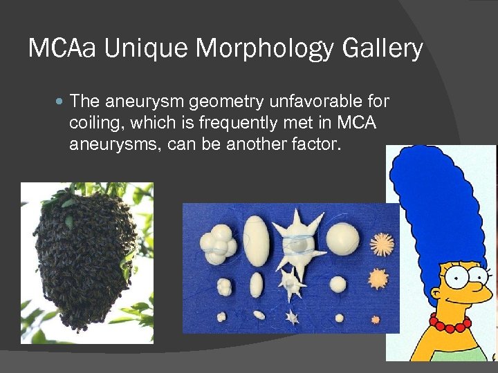 MCAa Unique Morphology Gallery The aneurysm geometry unfavorable for coiling, which is frequently met