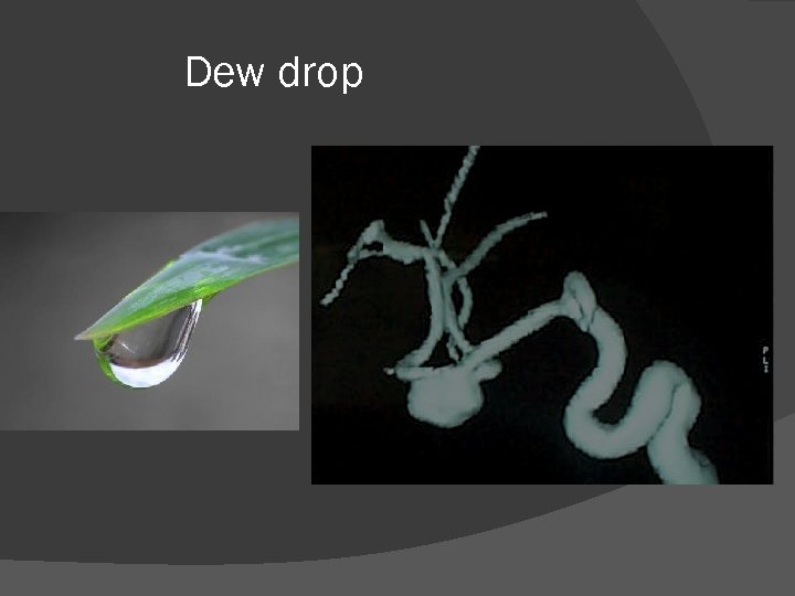 Dew drop 