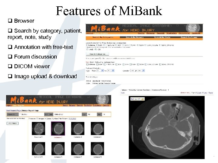 q Browser Features of Mi. Bank q Search by category, patient, report, note, study