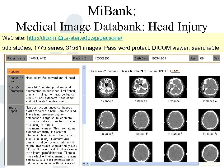 Mi. Bank: Medical Image Databank: Head Injury Web site: http: //dicom. i 2 r.