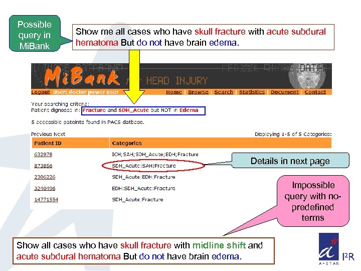Possible query in Mi. Bank Show me all cases who have skull fracture with