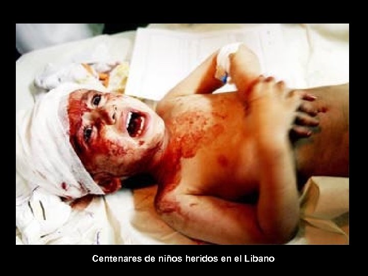 Centenares de niños heridos en el Libano 