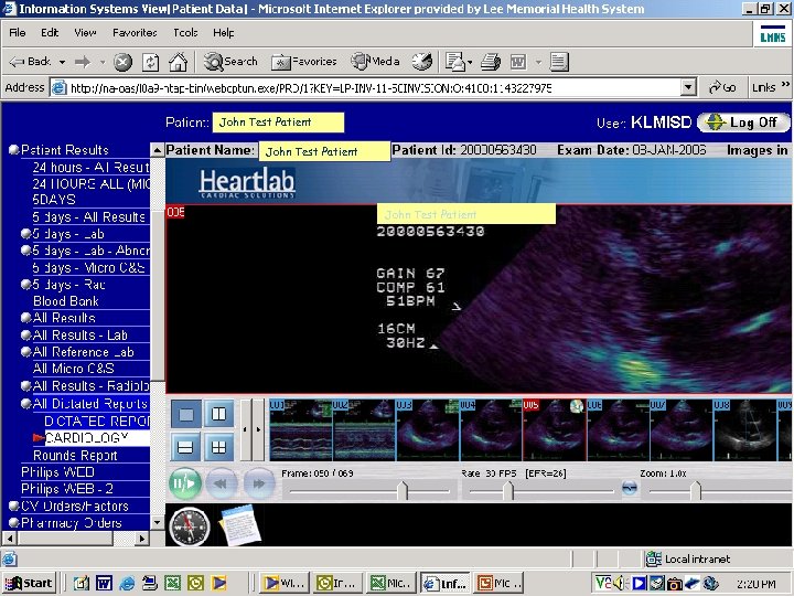 John Test Patient 53 