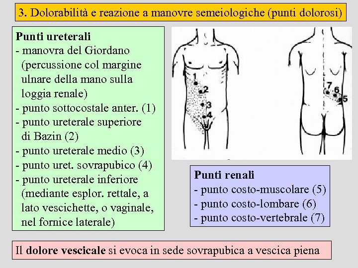 3. Dolorabilità e reazione a manovre semeiologiche (punti dolorosi) Punti ureterali - manovra del