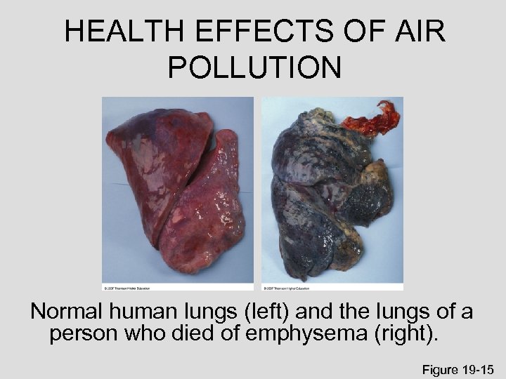 HEALTH EFFECTS OF AIR POLLUTION Normal human lungs (left) and the lungs of a