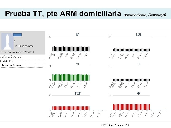 Prueba TT, pte ARM domiciliaria (telemedicina, Distansys) 