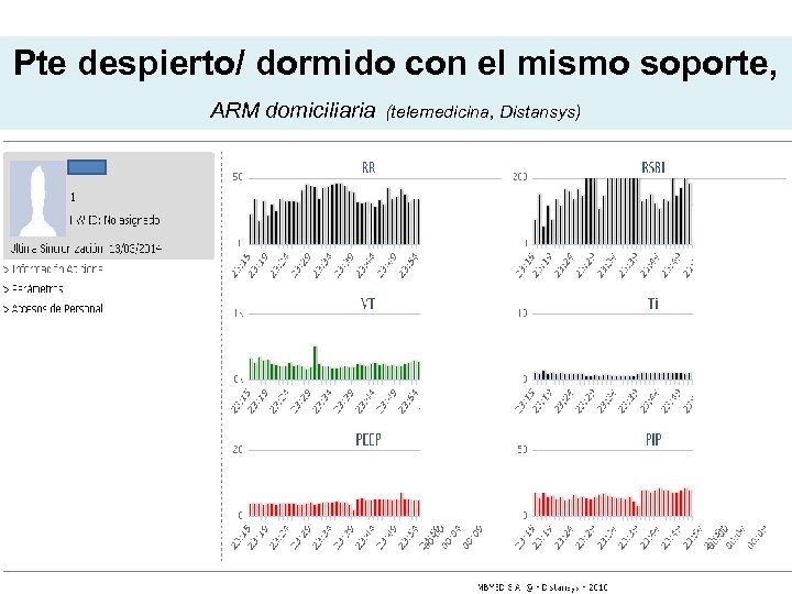 Pte despierto/ dormido con el mismo soporte, ARM domiciliaria (telemedicina, Distansys) 