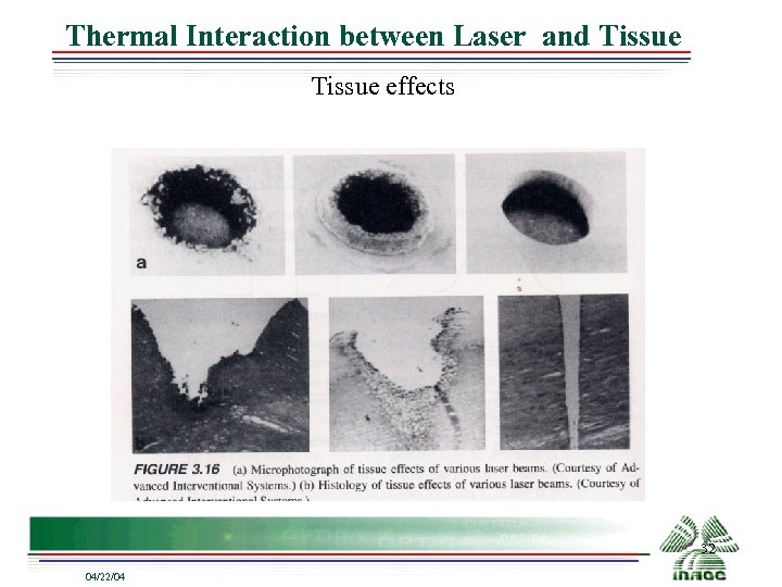 Thermal Interaction between Laser and Tissue effects 32 04/22/04 