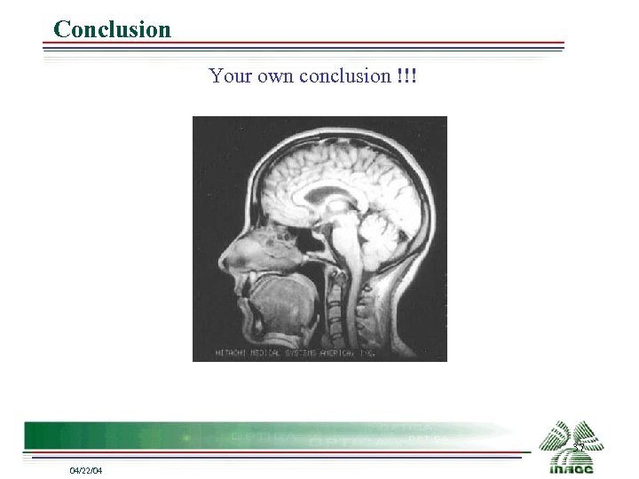 Conclusion Your own conclusion !!! 37 04/22/04 