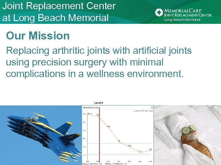 Joint Replacement Center at Long Beach Memorial Our Mission Replacing arthritic joints with artificial