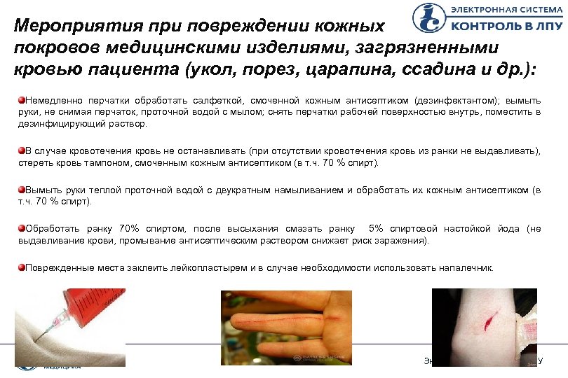 Мероприятия при повреждении кожных покровов медицинскими изделиями, загрязненными кровью пациента (укол, порез, царапина, ссадина