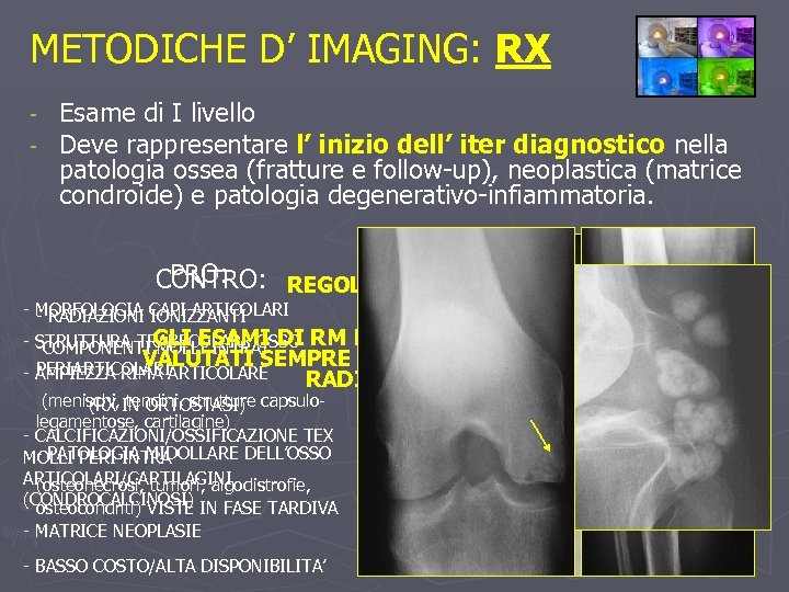 METODICHE D’ IMAGING: RX - Esame di I livello Deve rappresentare l’ inizio dell’