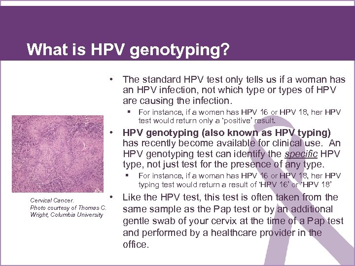 What is HPV genotyping? • The standard HPV test only tells us if a
