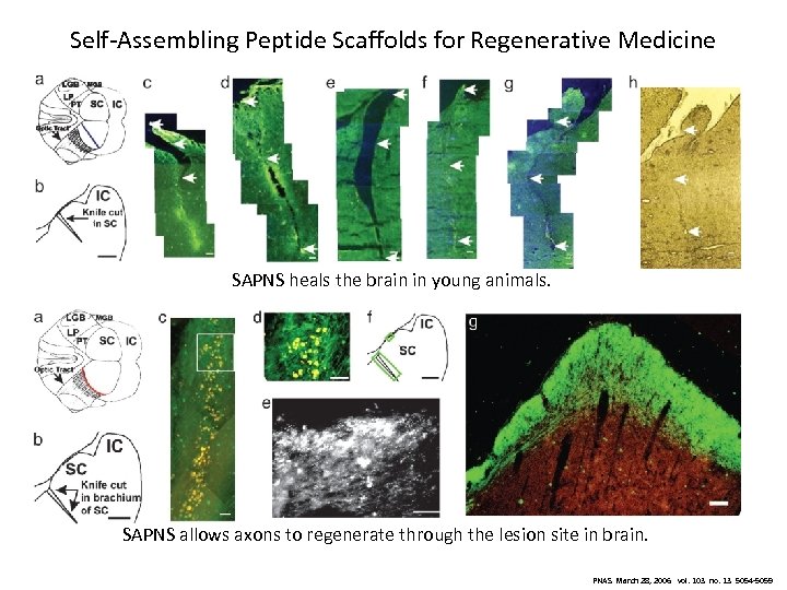 Self-Assembling Peptide Scaffolds for Regenerative Medicine SAPNS heals the brain in young animals. SAPNS