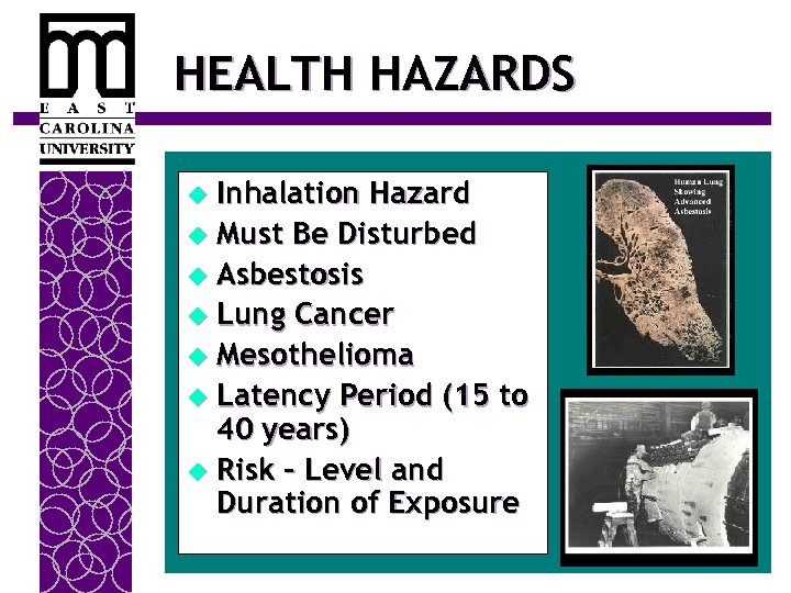 HEALTH HAZARDS Inhalation Hazard u Must Be Disturbed u Asbestosis u Lung Cancer u