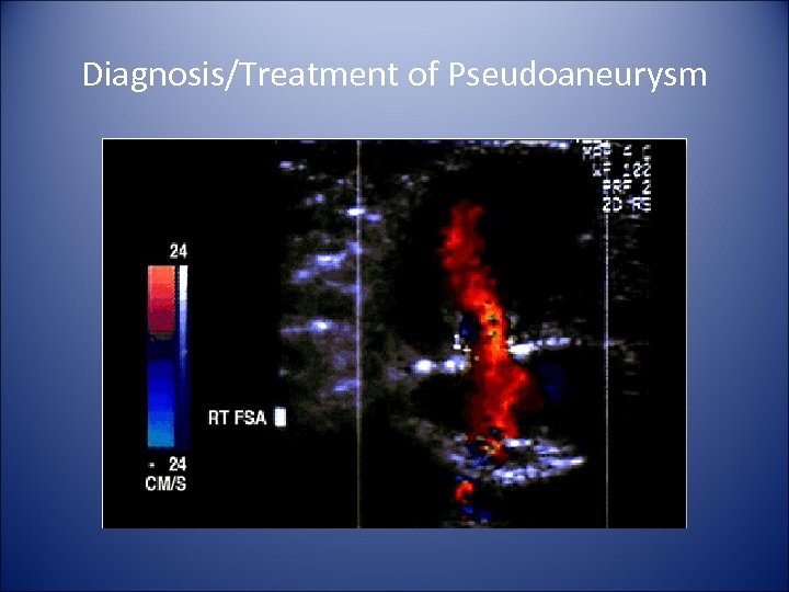 Diagnosis/Treatment of Pseudoaneurysm 