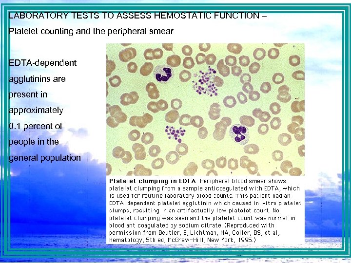 LABORATORY TESTS TO ASSESS HEMOSTATIC FUNCTION – Platelet counting and the peripheral smear EDTA-dependent