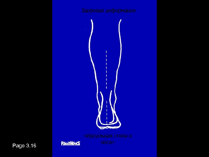 Здоровая деформация Page 3. 16 «Идеальная стопа и нога» 