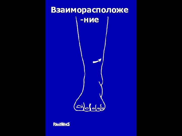 Взаиморасположе -ние 