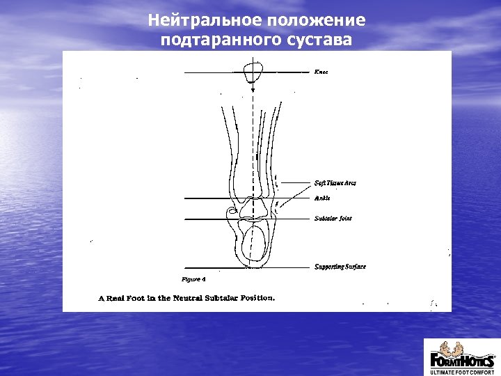 Нейтральное положение подтаранного сустава 