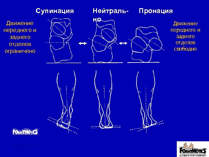 Супинация Движение переднего и заднего отделов ограничено Page 3. 21 Нейтрально Пронация Движение переднего