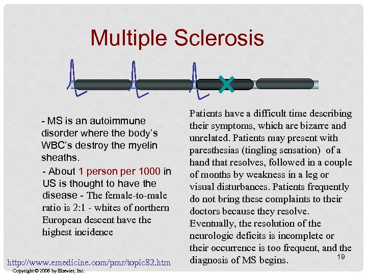 Multiple Sclerosis - MS is an autoimmune disorder where the body’s WBC’s destroy the