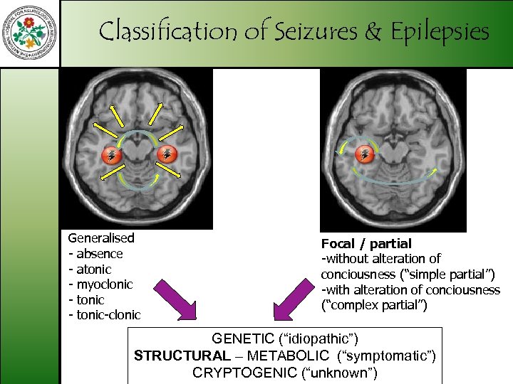 Classification of Seizures & Epilepsies Generalised - absence - atonic - myoclonic - tonic-clonic
