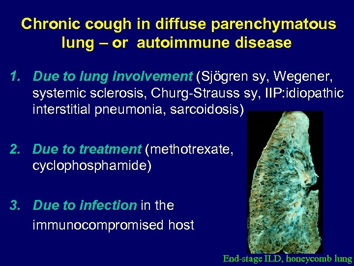 Chronic cough in diffuse parenchymatous lung – or autoimmune disease 1. Due to lung