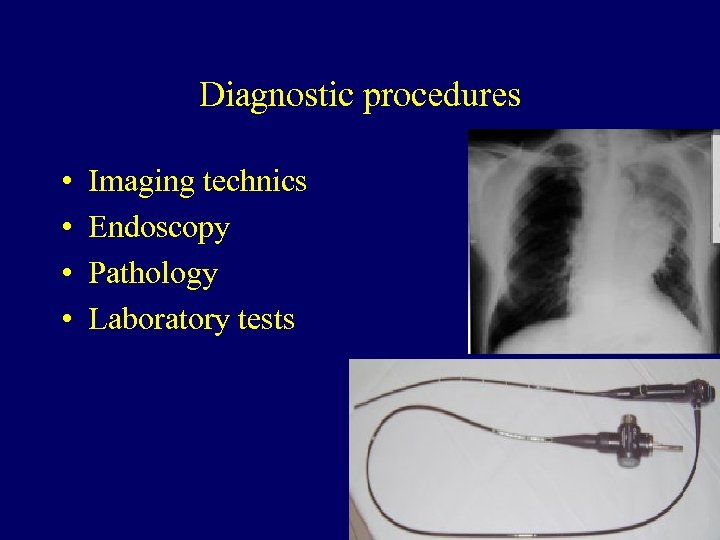 Diagnostic procedures • • Imaging technics Endoscopy Pathology Laboratory tests 62 