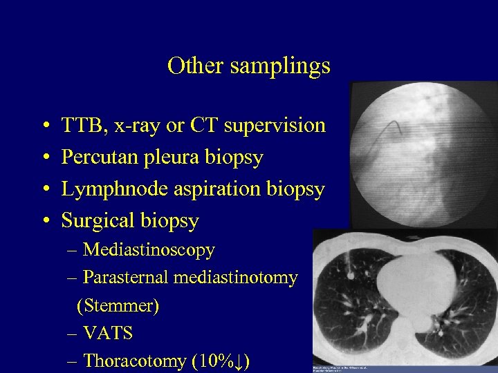 Other samplings • • TTB, x-ray or CT supervision Percutan pleura biopsy Lymphnode aspiration