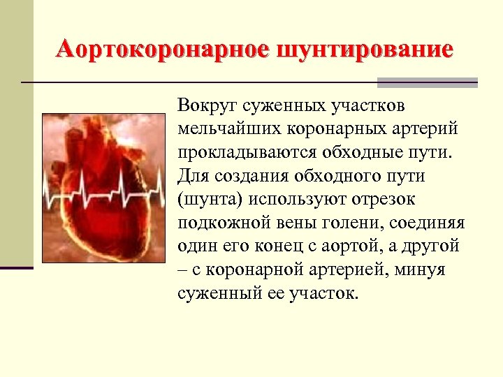 Аортокоронарное шунтирование как делается